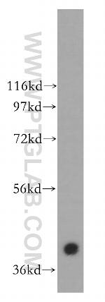 CACNG3 Antibody in Western Blot (WB)