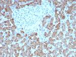 CPS1/Carbamoyl-Phosphate Synthetase (Hepatocellular Marker) Antibody in Immunohistochemistry (Paraffin) (IHC (P))