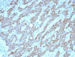 CPS1/Carbamoyl-Phosphate Synthetase (Hepatocellular Marker) Antibody in Immunohistochemistry (Paraffin) (IHC (P))