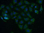 CAMK2 Antibody in Immunocytochemistry (ICC/IF)