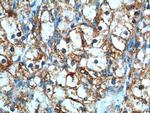 CAMK2 Antibody in Immunohistochemistry (Paraffin) (IHC (P))