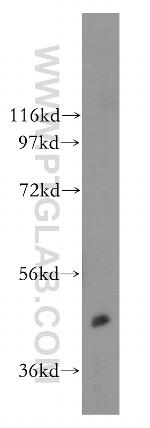 CAMK2 Antibody in Western Blot (WB)