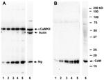 CaMKII alpha Antibody in Western Blot (WB)