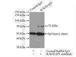 RACGAP1 Antibody in Immunoprecipitation (IP)