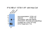 RACGAP1 Antibody in Immunoprecipitation (IP)