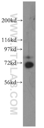 RACGAP1 Antibody in Western Blot (WB)