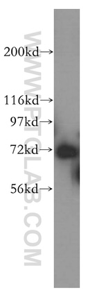 RACGAP1 Antibody in Western Blot (WB)