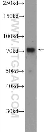 RACGAP1 Antibody in Western Blot (WB)