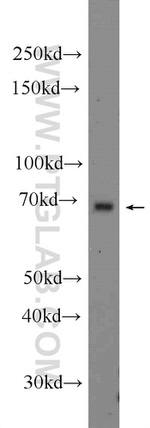 RACGAP1 Antibody in Western Blot (WB)