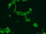 DUT Antibody in Immunocytochemistry (ICC/IF)