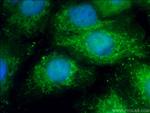 MX1 Antibody in Immunocytochemistry (ICC/IF)