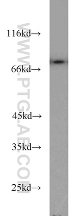 MX1 Antibody in Western Blot (WB)