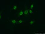 MYST2 Antibody in Immunocytochemistry (ICC/IF)