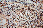 MYST2 Antibody in Immunohistochemistry (Paraffin) (IHC (P))