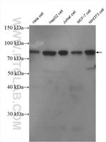MYST2 Antibody in Western Blot (WB)