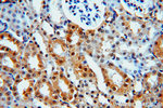 MYST2 Antibody in Immunohistochemistry (Paraffin) (IHC (P))