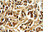 MYST2 Antibody in Immunohistochemistry (Paraffin) (IHC (P))