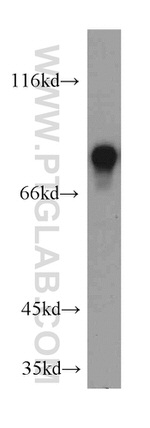 MYST2 Antibody in Western Blot (WB)