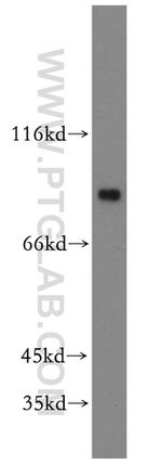 MYST2 Antibody in Western Blot (WB)