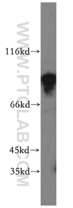 MYST2 Antibody in Western Blot (WB)