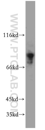 MYST2 Antibody in Western Blot (WB)