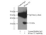 RNase T2 Antibody in Immunoprecipitation (IP)