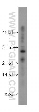 RNase T2 Antibody in Western Blot (WB)