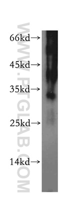 RNase T2 Antibody in Western Blot (WB)