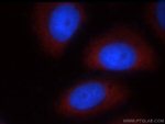 FMRP Antibody in Immunocytochemistry (ICC/IF)