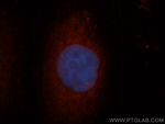 FMRP Antibody in Immunocytochemistry (ICC/IF)