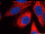 FMRP Antibody in Immunocytochemistry (ICC/IF)