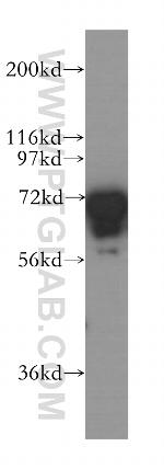 FMRP Antibody in Western Blot (WB)