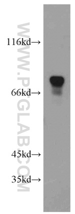 FMRP Antibody in Western Blot (WB)