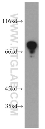 FMRP Antibody in Western Blot (WB)