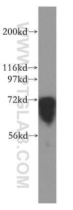 FMRP Antibody in Western Blot (WB)