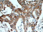 P4HA2 Antibody in Immunohistochemistry (Paraffin) (IHC (P))