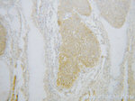 P4HA2 Antibody in Immunohistochemistry (Paraffin) (IHC (P))