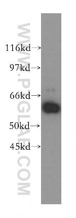 P4HA2 Antibody in Western Blot (WB)