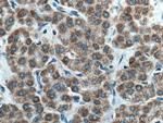 AMBRA1 Antibody in Immunohistochemistry (Paraffin) (IHC (P))