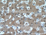 PFKFB3 Antibody in Immunohistochemistry (Paraffin) (IHC (P))