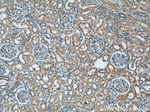 PFKFB3 Antibody in Immunohistochemistry (Paraffin) (IHC (P))