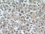 PFKFB3 Antibody in Immunohistochemistry (Paraffin) (IHC (P))