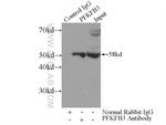 PFKFB3 Antibody in Immunoprecipitation (IP)