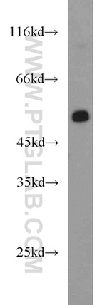 PFKFB3 Antibody in Western Blot (WB)