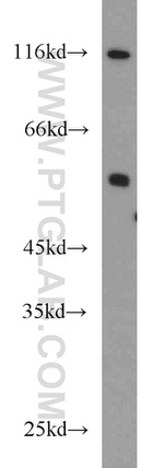 PFKFB3 Antibody in Western Blot (WB)