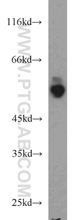 PFKFB3 Antibody in Western Blot (WB)