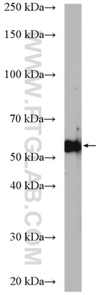 PFKFB3 Antibody in Western Blot (WB)