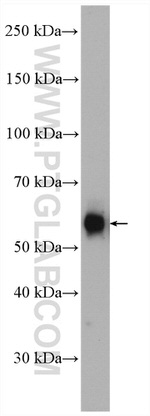 PFKFB3 Antibody in Western Blot (WB)