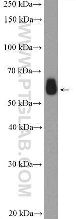 PFKFB3 Antibody in Western Blot (WB)