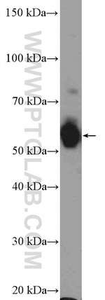 PFKFB3 Antibody in Western Blot (WB)